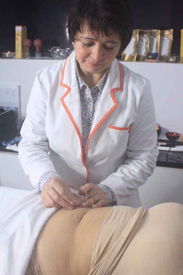 Acupuntura - Imatge 2